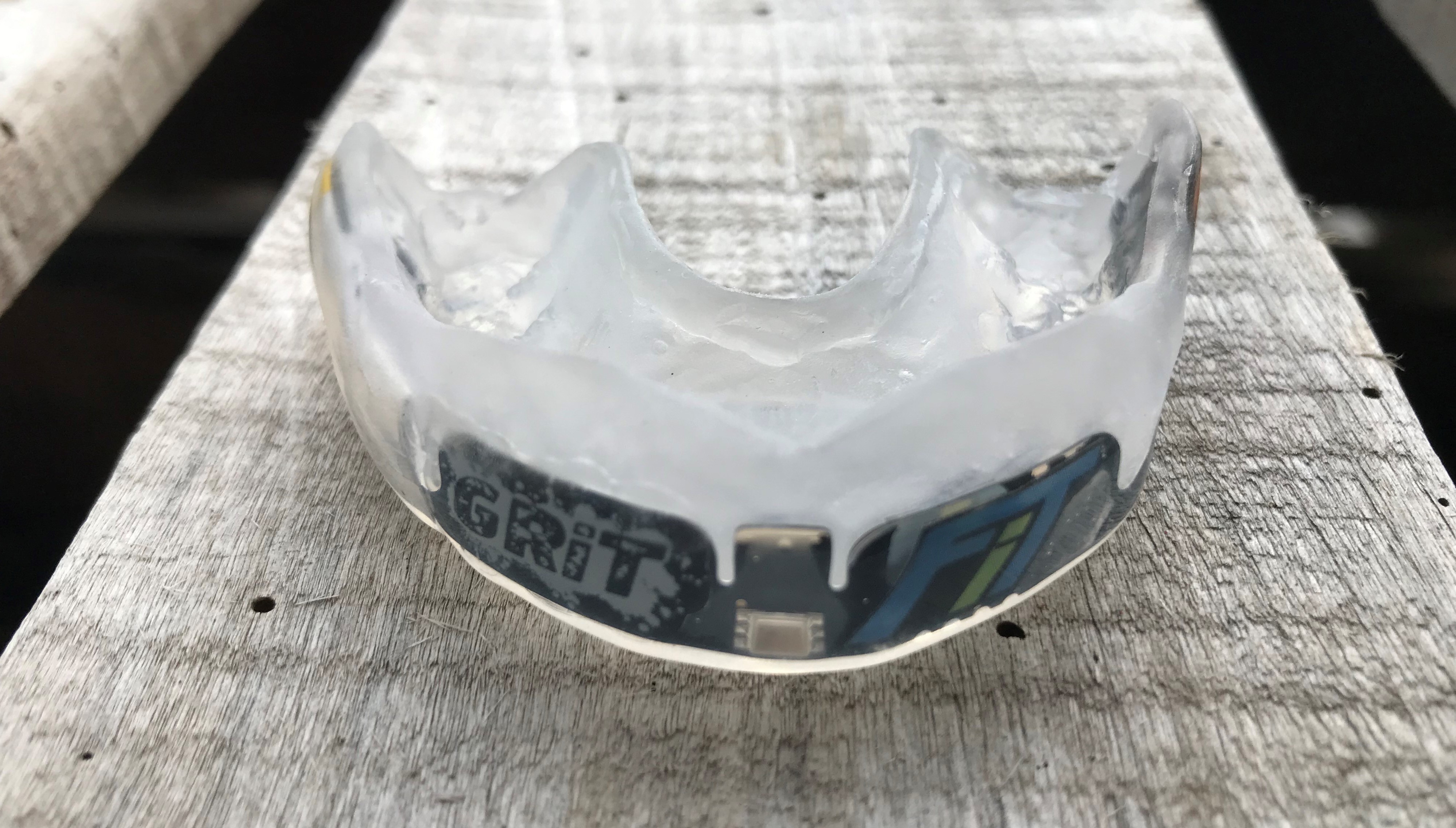 protege-dent-2.jpg protege-dent-2.jpg